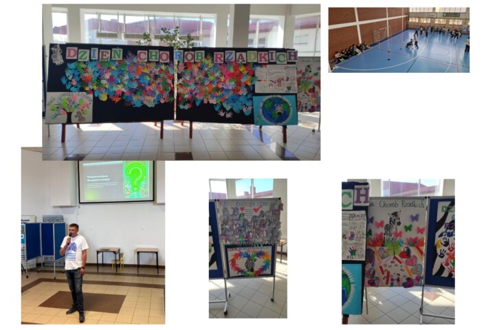 Dzień Chorób Rzadkich w Publicznej Szkole Podstawowej nr 2 im. Jana Pawła II w Szydłowcu