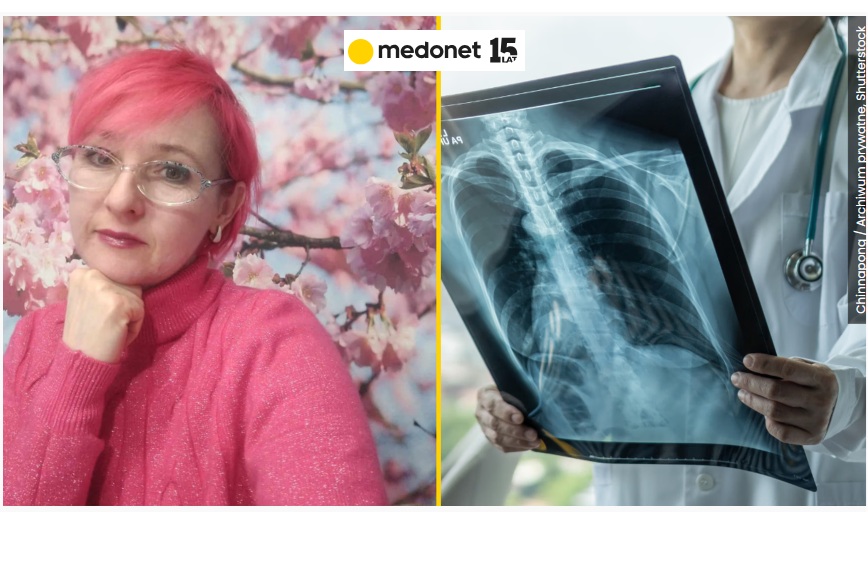 Historia pacjentki z nadciśnieniem płucnym A123999